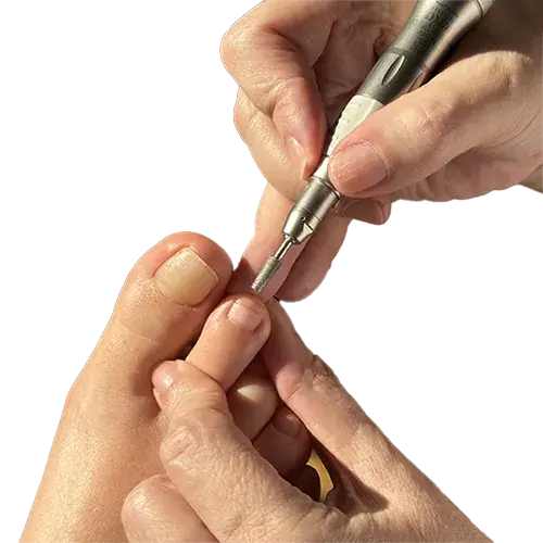 Billede af negle der bliver fræset